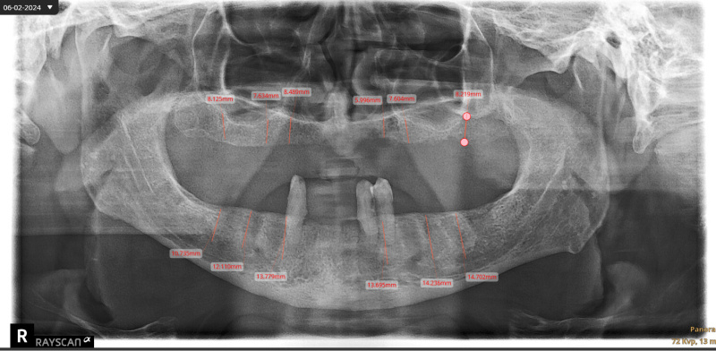 British Shorthair, Kedi  mia fotoğrafı