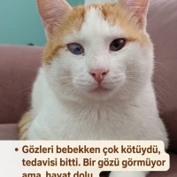 Görme eng..