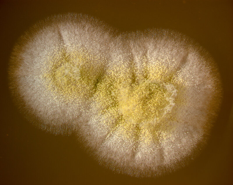 aspergilloz mantarının mikroskop görüntüsü