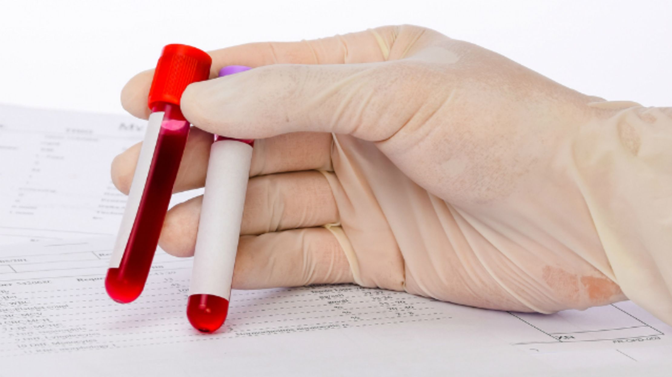 kan dolu test tüpleri