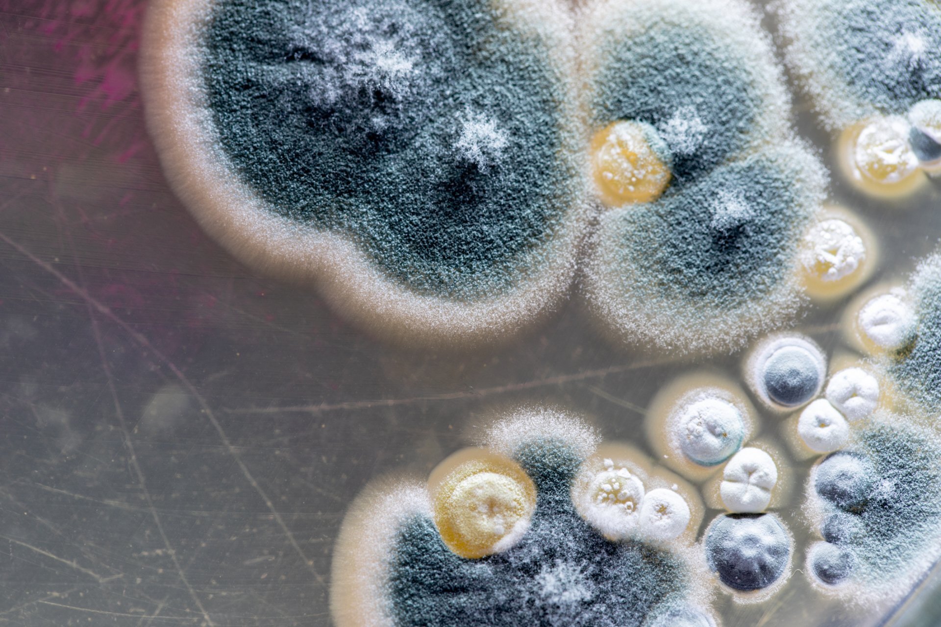 mikroskobik mantar görünümü
